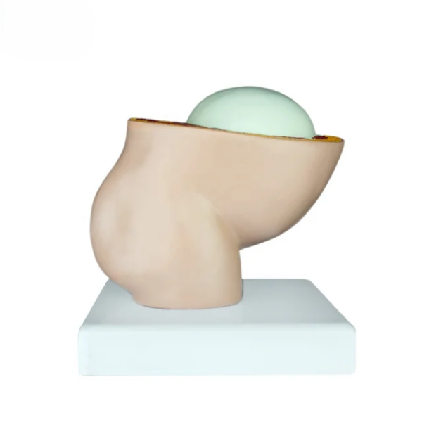 PREGNANCY PELVIS WITH FETUS - Image 3