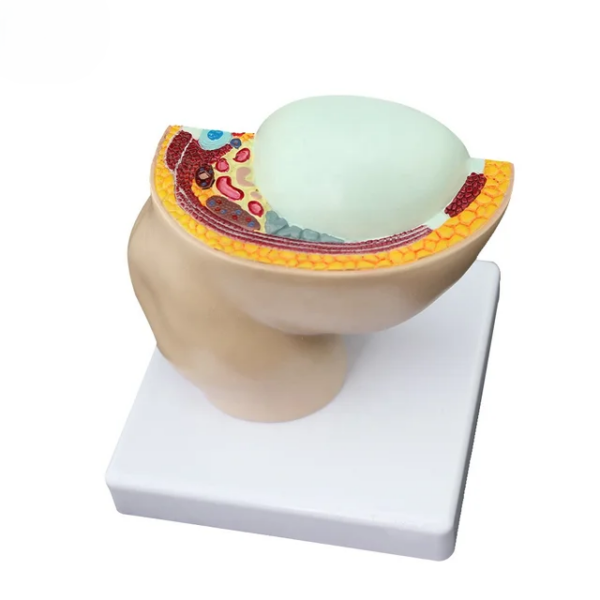 PREGNANCY PELVIS WITH FETUS - Image 2